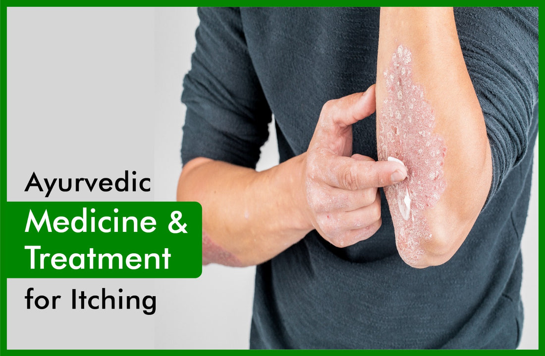 itching ayurvedic medicine