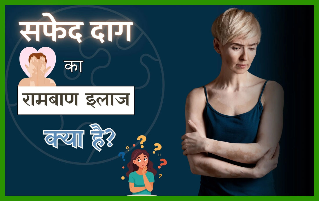 सफेद दाग का रामबाण इलाज क्या है, चेहरे पर सफेद दाग हटाने के घरेलू उपाय, सफेद दाग उपचार, ilaj safed daag