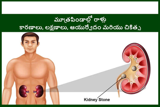 కిడ్నీ స్టోన్ కారణాలు, లక్షణాలు, రకాలు, ఆయుర్వేద ఔషధం మరియు చికిత్స