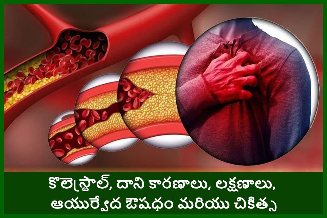 ఆయుర్వేదం మరియు దాని నిరూపితమైన ఆయుర్వేద ఔషధం ప్రకారం కొలెస్ట్రాల్ - లైఫ్ గార్డ్ అడ్వాన్స్