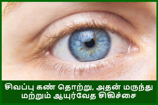 கான்ஜுன்க்டிவிடிஸ் அல்லது சிவப்பு கண் தொற்று என்றால் என்ன, அதன் மருந்து மற்றும் சிகிச்சையை ஆயுர்வேதத்தில் அறிந்து கொள்ளுங்கள்