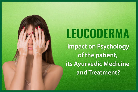Leucoderma/Vitiligo Ayurvedic Medicine