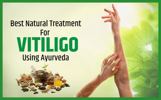 ayurvedic medicine for vitiligo