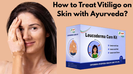 Ayurvedic Medicine for Vitiligo