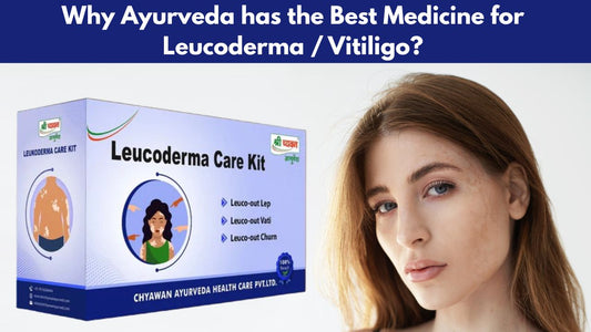 Ayurvedic Medicine for Vitiligo