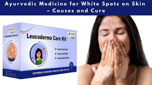 Ayurvedic Medicine for Vitiligo