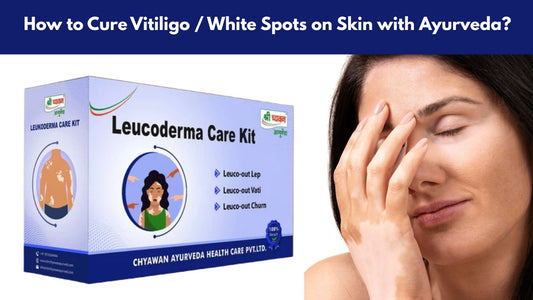 Ayurvedic Medicine for Vitiligo