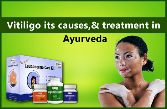 Vitiligo Treatment in Ayurveda