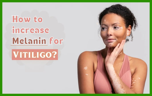 How to increase Melanin for Vitiligo