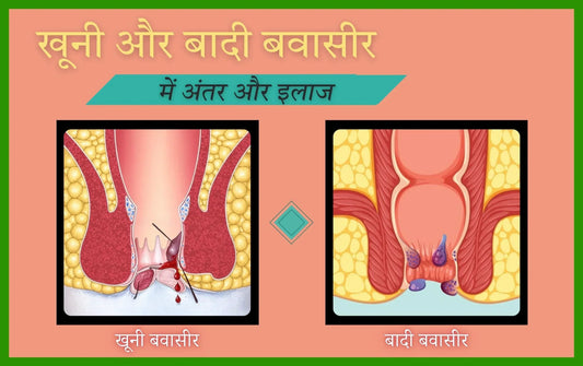 khooni aur badi bawaseer mein antar