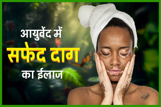 सफेद दागSafed daag होने के कारणcauses और आयुर्वेद में ईलाजTreatment