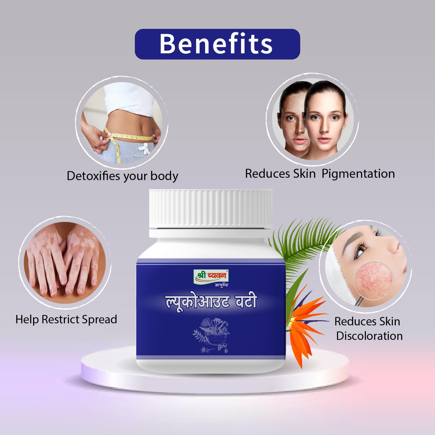 skin condition with white patches