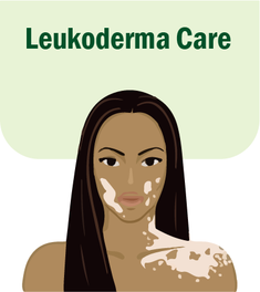 Leukoderma Care