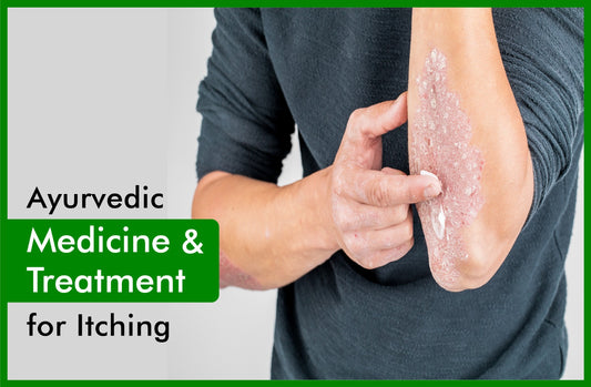 itching ayurvedic medicine