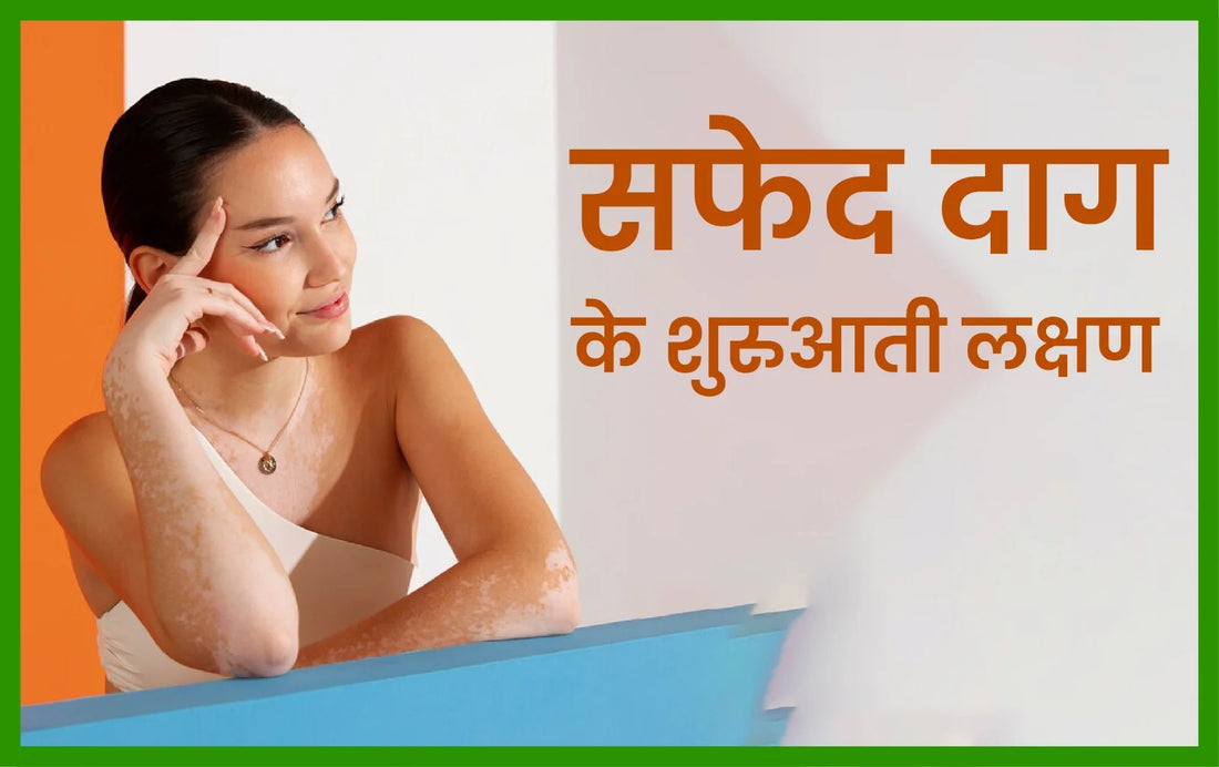 सफेद दाग के शुरुआती लक्षण, सफेद दाग ठीक होने के लक्षण, सफेद दाग का रामबाण इलाज क्या है, safed daag kaise hota hai