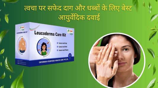 Ayurvedic Medicine for Leucoderma