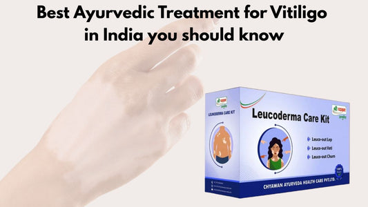 Ayurvedic Medicine for Vitiligo