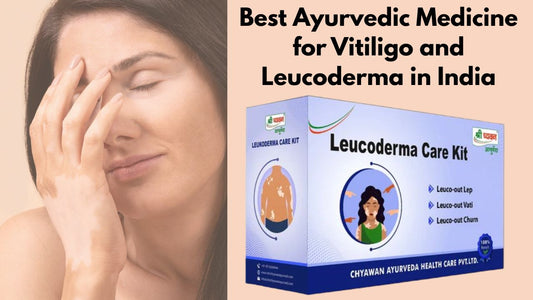 Ayurvedic Medicine for Vitiligo