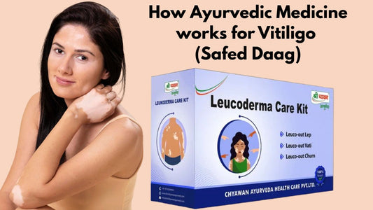 Ayurvedic Medicine for Vitiligo