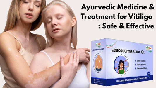 Ayurvedic Medicine for Vitiligo