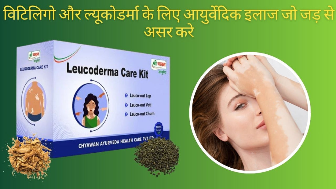 Leucoderma Ayurvedic Treatment