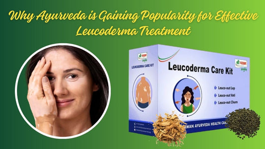 Leucoderma Treatment