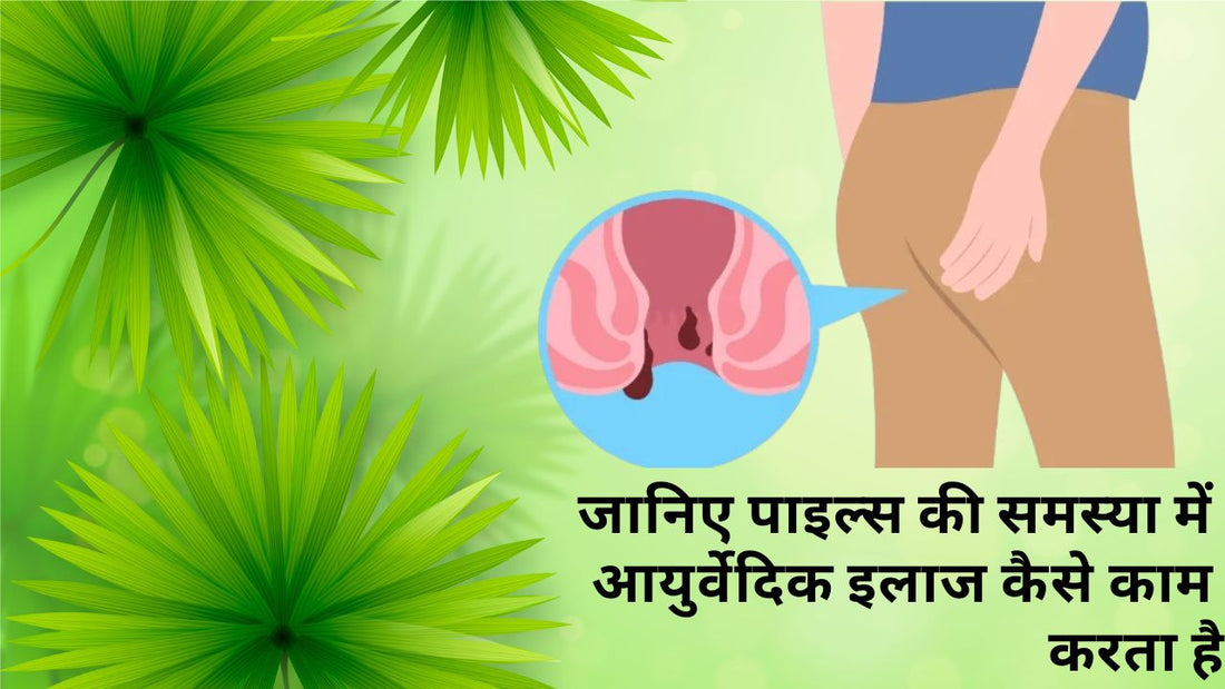 Ayurvedic treatment for piles