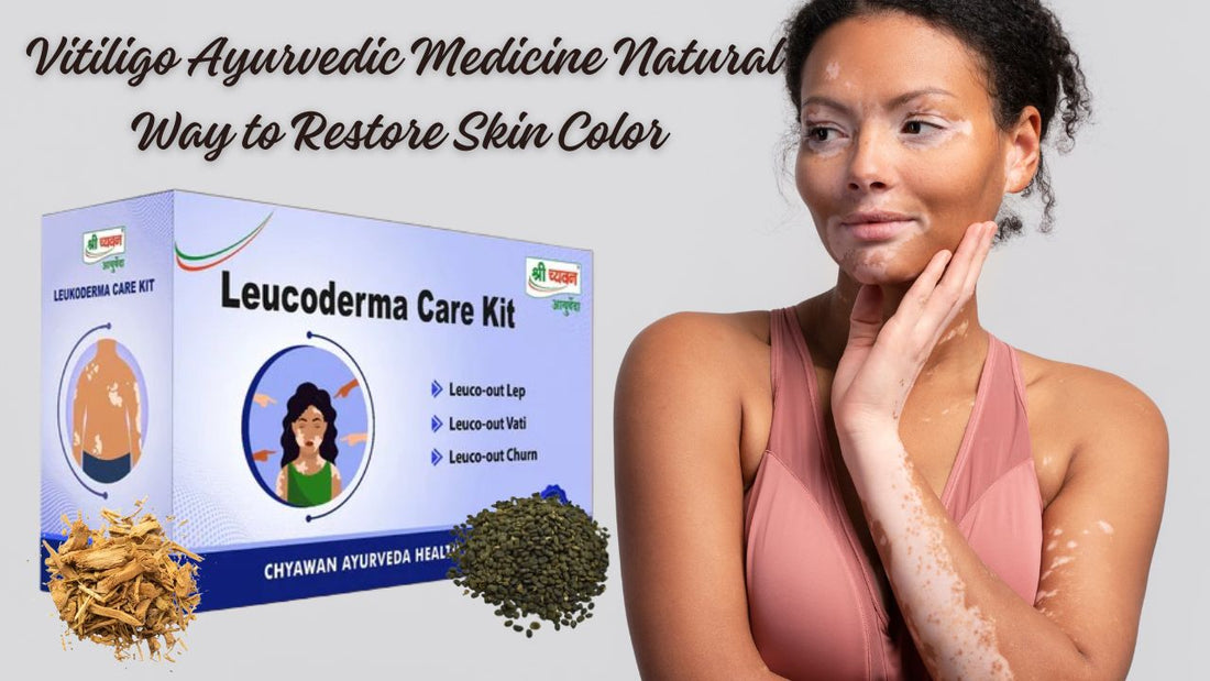 Best Ayurvedic Medicine for Vitiligo