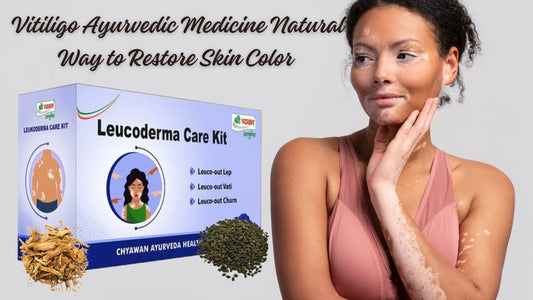 Best Ayurvedic Medicine for Vitiligo