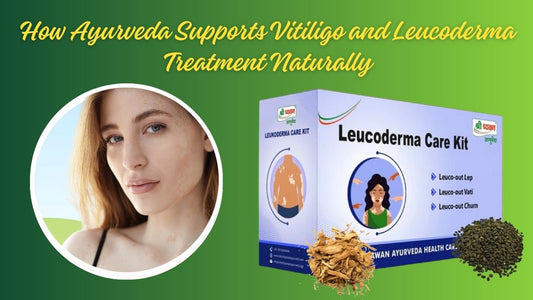 Vitiligo Medicine