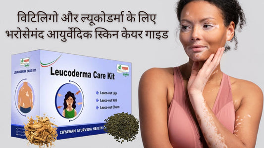 Best ayurvedic medicine for Vitiligo