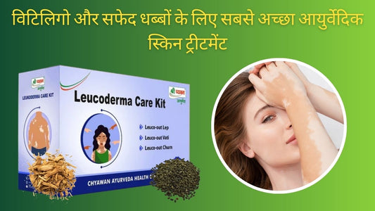 White Patches on Skin Ayurvedic Treatment
