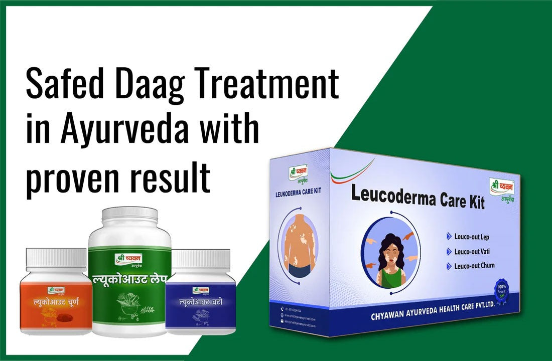 Safed Daag Treatment