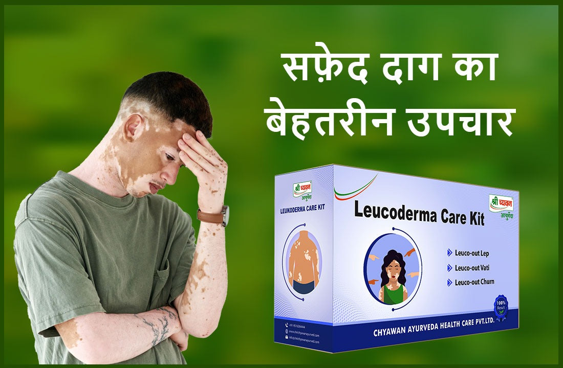 Safed Daag or Leucoderma का प्रभाव और Ayurveda के आधार पर Treatment