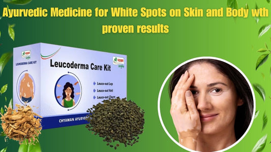 ayurvedic medicine for Leucoderma
