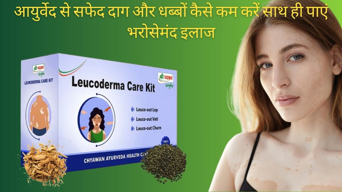 ayurvedic medicine for Leucoderma