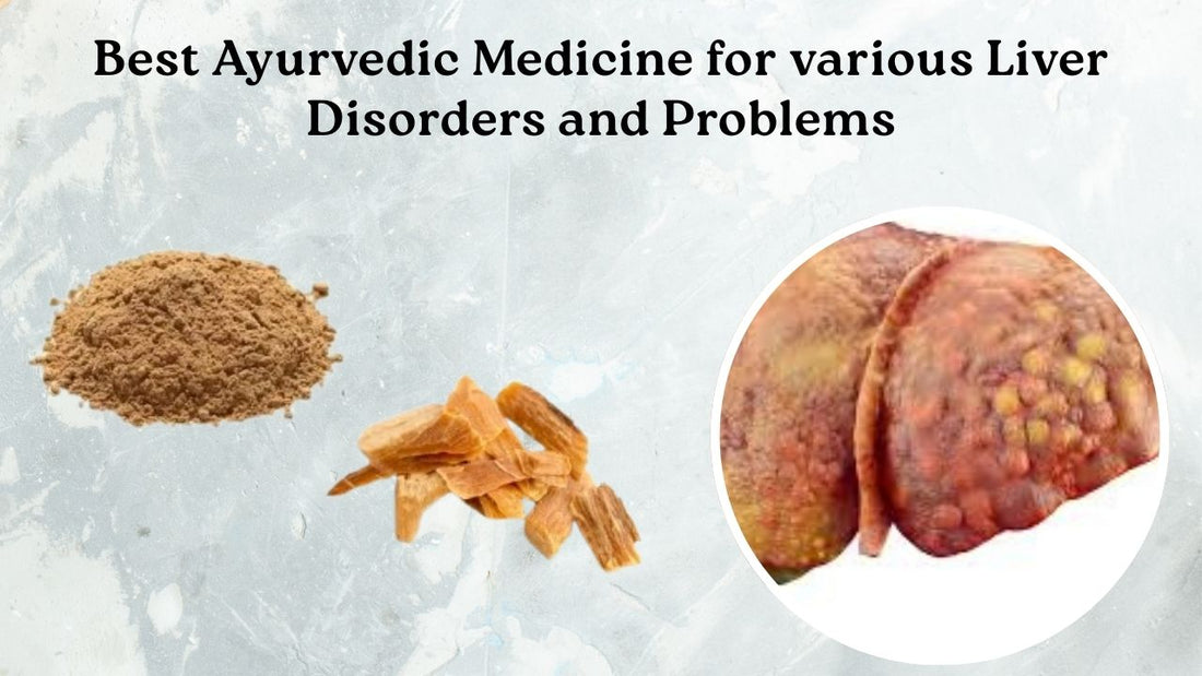 ayurvedic medicine for liver