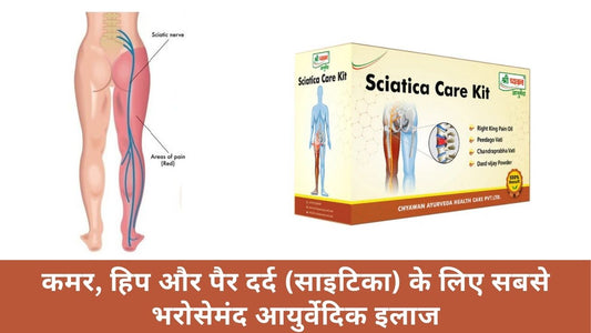 Ayurvedic Medicine for Sciatica Pain