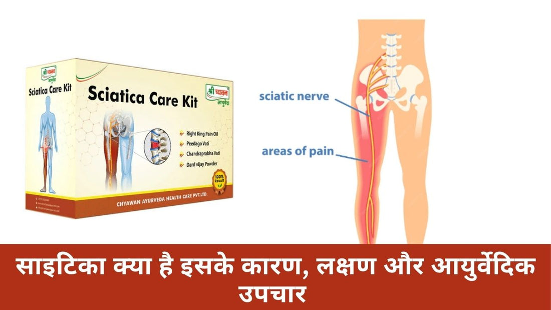 साइटिका क्या है इसके कारण, लक्षण और आयुर्वेदिक उपचार