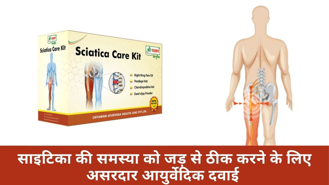 Ayurvedic Medicine for Sciatica