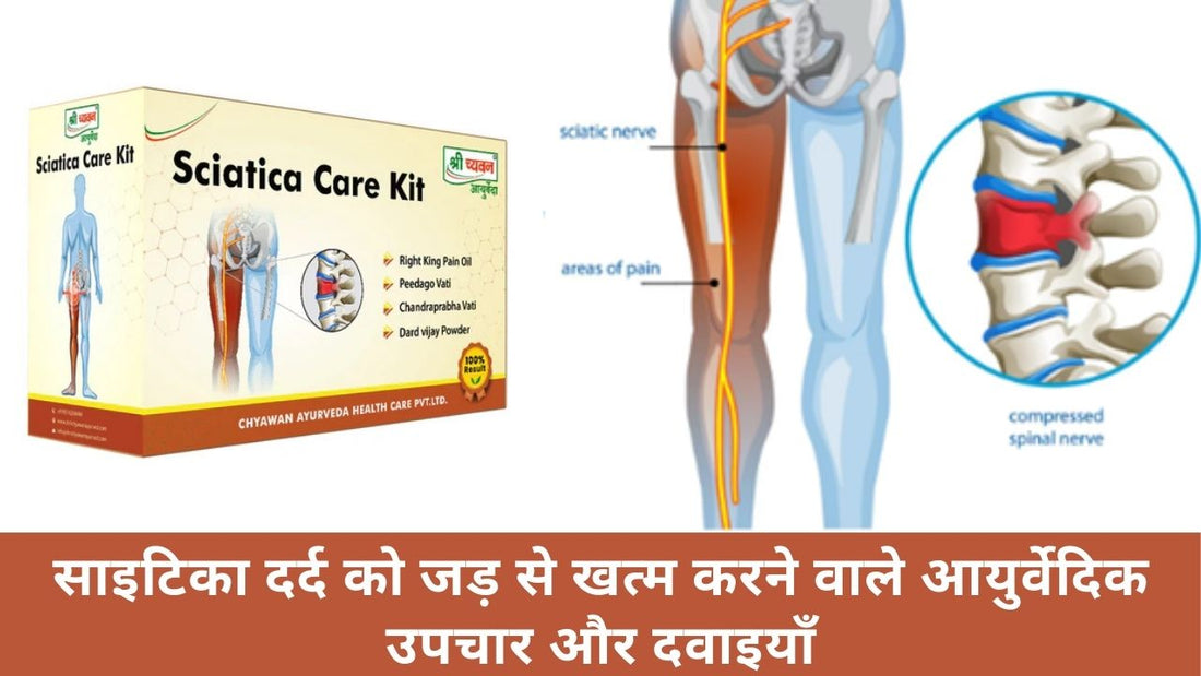 ayurvedic medicine for sciatica pain