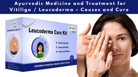Ayurvedic Medicine for Vitiligo