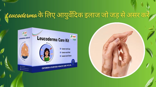 Ayurvedic treatment for leucoderma