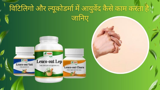 ayurvedic medicine for vitiligo