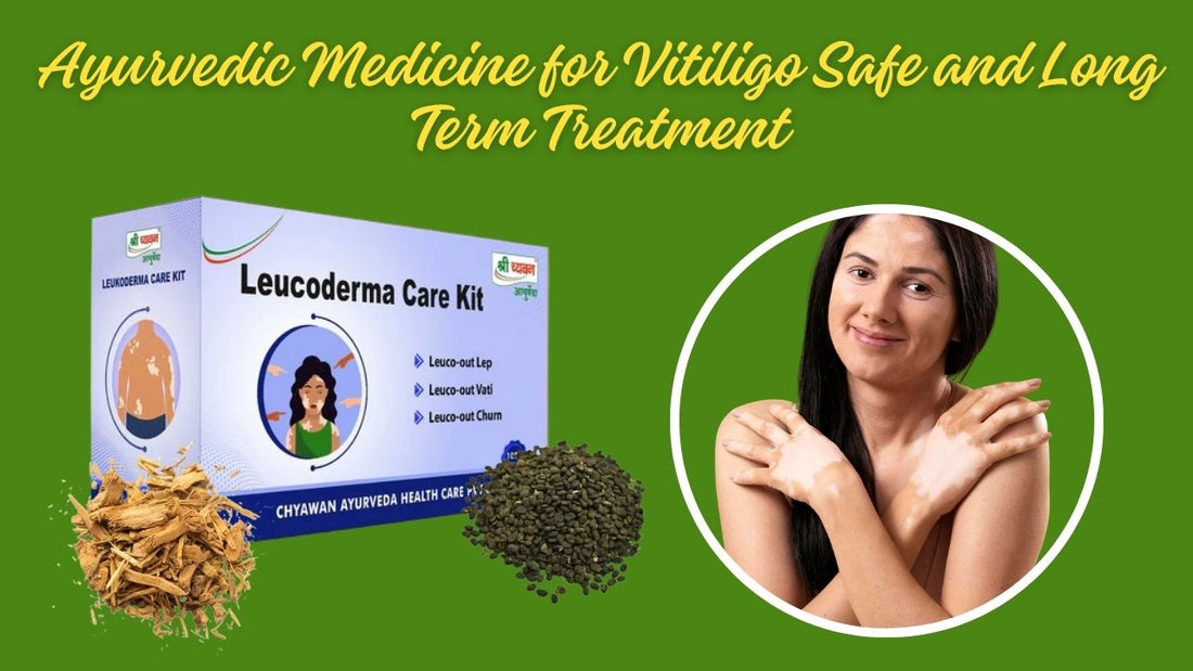 vitiligo ayurvedic medicine