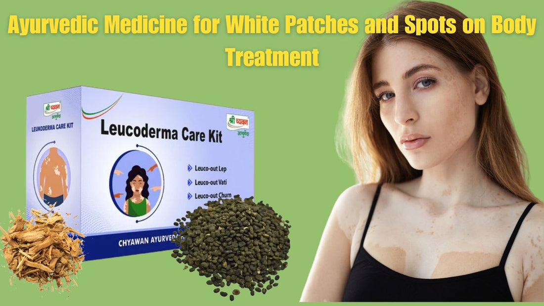 Ayurvedic Medicine for white patches and spots