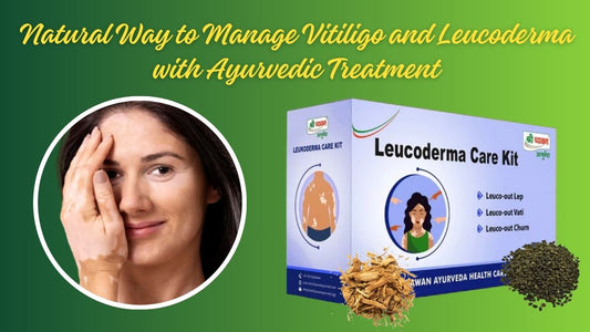 Vitiligo ayurvedic treatment