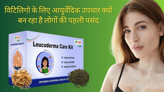 Vitiligo Ayurvedic Treatment