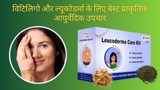 Leucoderma ayurvedic treatment