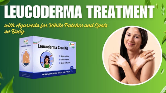 Leucoderma Treatment